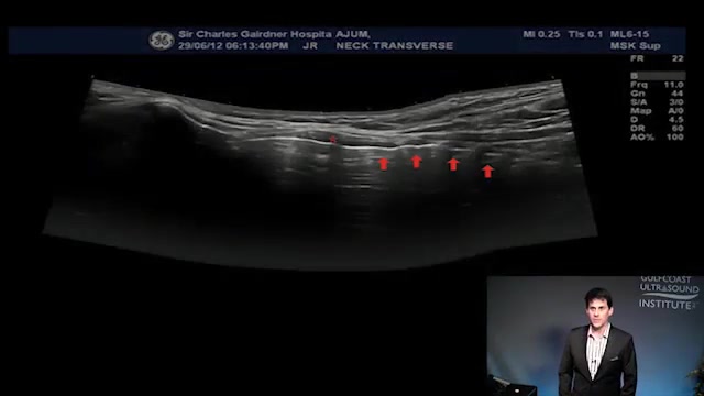 Advanced Lung Ultrasound Applications